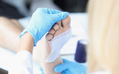 Treating Foot Infections in Diabetics: What to Expect