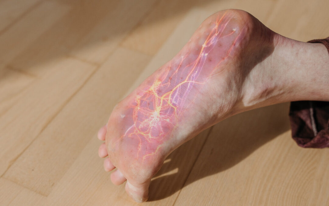 Diabetic Neuropathy: Early Signs, Prevention Tips, and When to See a Podiatrist